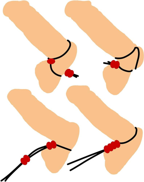 Pierścień erekcyjny typu "lasso", na penisa i jądra, z regulowanym obwodem, silikon Pierścień erekcyjny typu "lasso", na penisa i jądra, z regulowanym obwodem, silikon